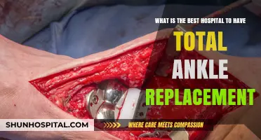 Top Hospitals for Total Ankle Replacements: Expert Care and Recovery