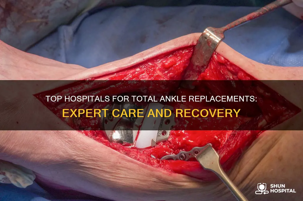 what is the best hospital to have total ankle replacements