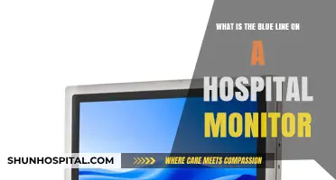 Understanding the Blue Line on Hospital Monitors: Vital Signs Explained