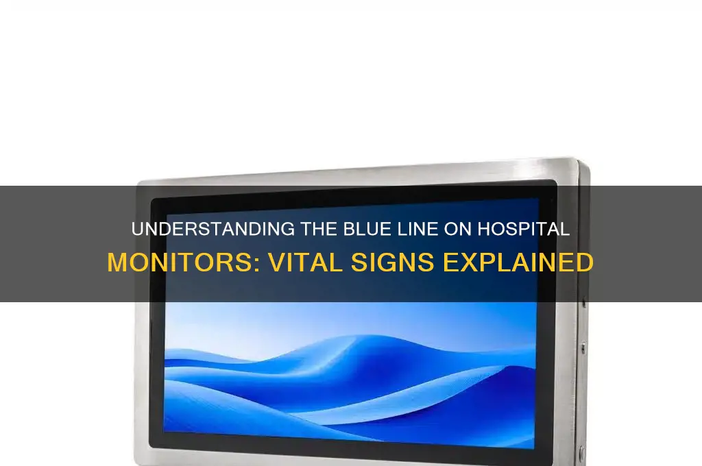 what is the blue line on a hospital monitor