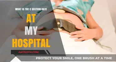 Understanding C-Section Rates: A Closer Look at Your Hospital's Statistics