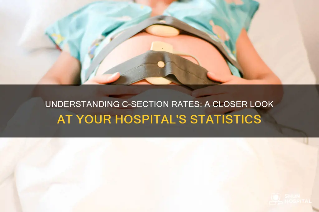 what is the c section rate at my hospital