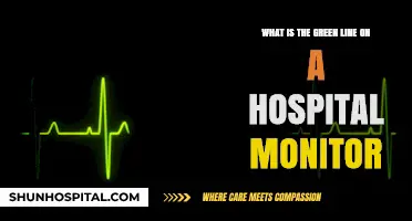 Understanding the Green Line on Hospital Monitors: A Vital Sign Explained