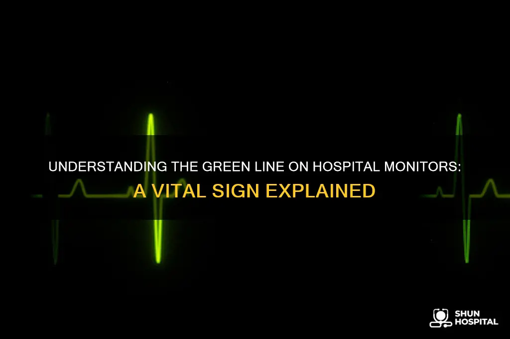 what is the green line on a hospital monitor