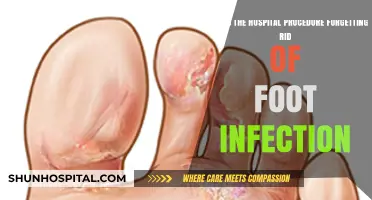 Effective Hospital Procedures for Treating and Eliminating Foot Infections