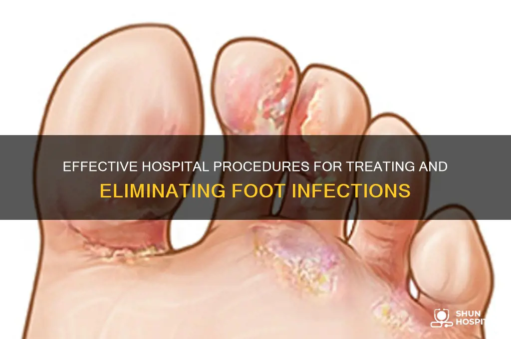 what is the hospital procedure forgetting rid of foot infection