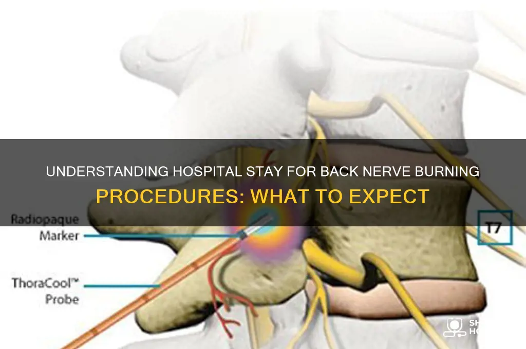 what is the hospital stay for burning nerves in back