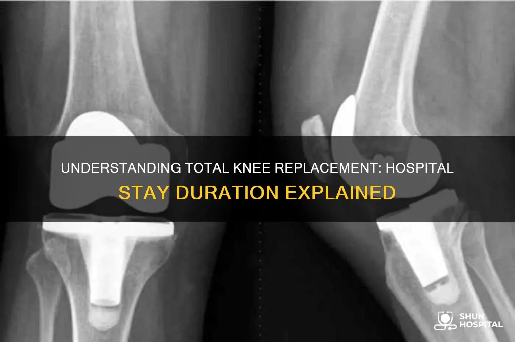 what is the hospital time for a total knee replacement