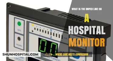 Understanding the Imped Line on Hospital Monitors: A Comprehensive Guide
