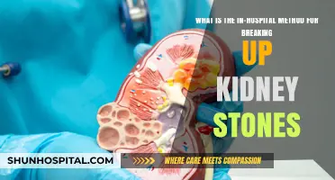 Effective In-Hospital Techniques for Breaking Up Kidney Stones Explained
