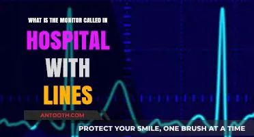 Understanding Hospital Monitors: The Purpose of Line Displays Explained