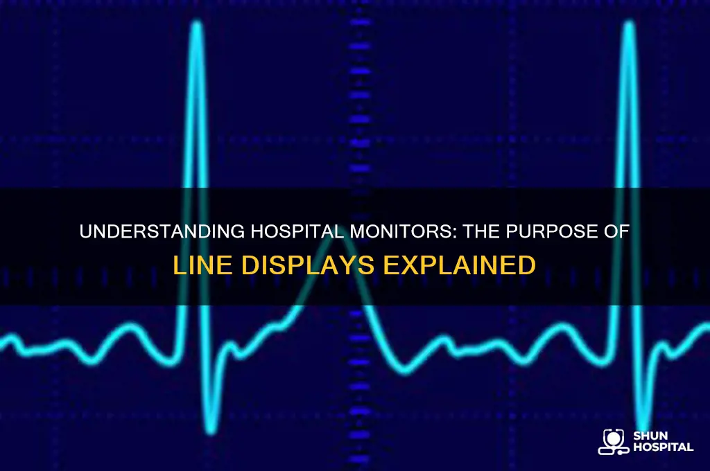 what is the monitor called in hospital with lines