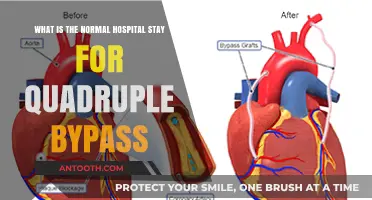 Understanding Quadruple Bypass Surgery: Typical Hospital Stay Duration Explained