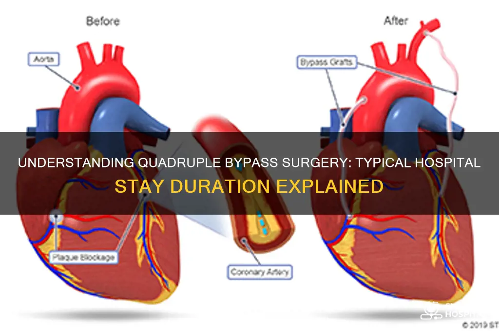 what is the normal hospital stay for quadruple bypass