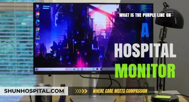 Understanding the Purple Line on Hospital Monitors: A Quick Guide