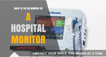 Understanding the RR Number on Hospital Monitors: A Comprehensive Guide