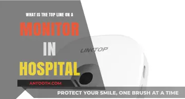 Understanding the Critical Top Line on Hospital Monitors: A Quick Guide