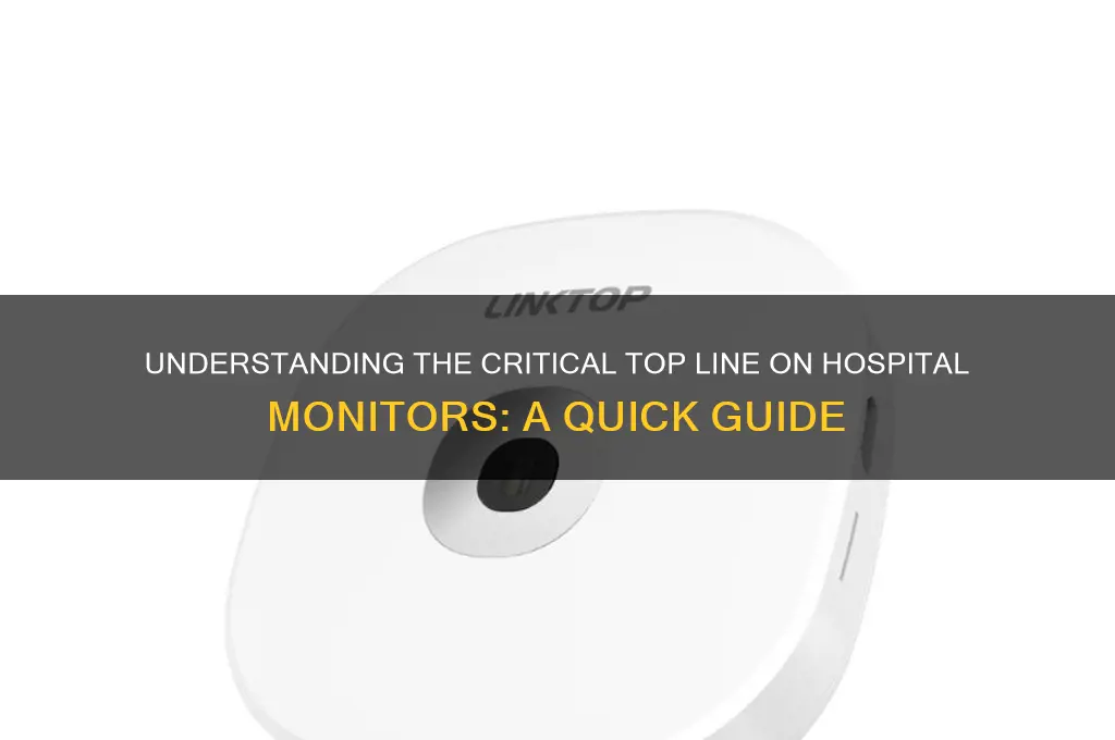 what is the top line on a monitor in hospital