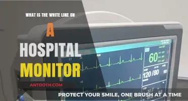 Understanding the White Line on Hospital Monitors: A Lifesaving Signal Explained