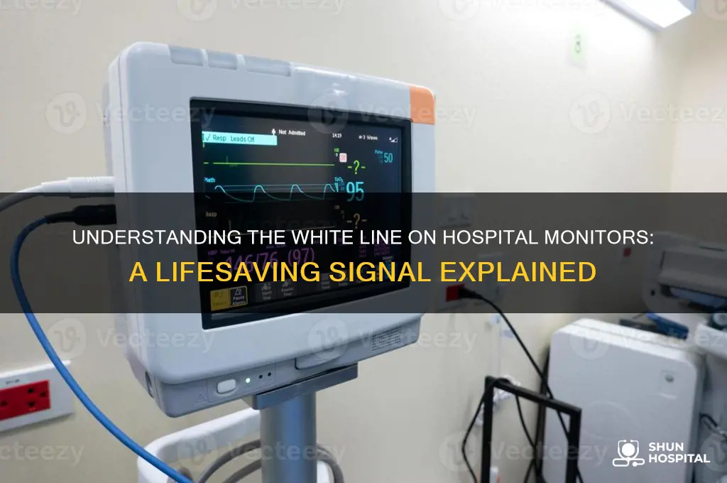 what is the white line on a hospital monitor