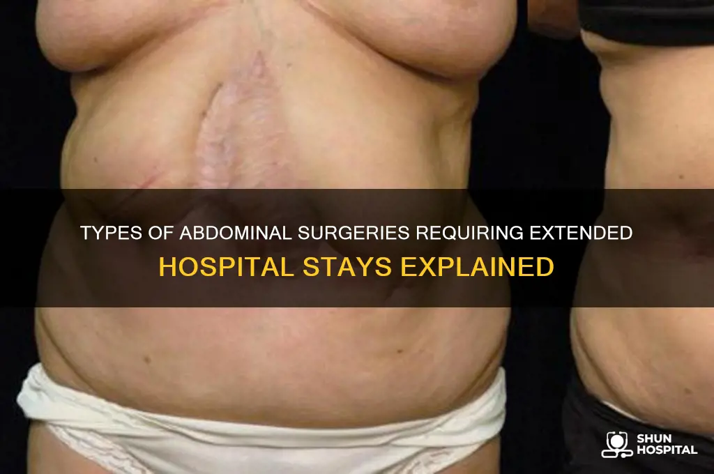 what kind of abdominal surgery keeps you in the hospital