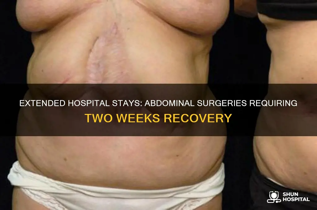 what kind of abdominal surgery needs two weeks in hospital