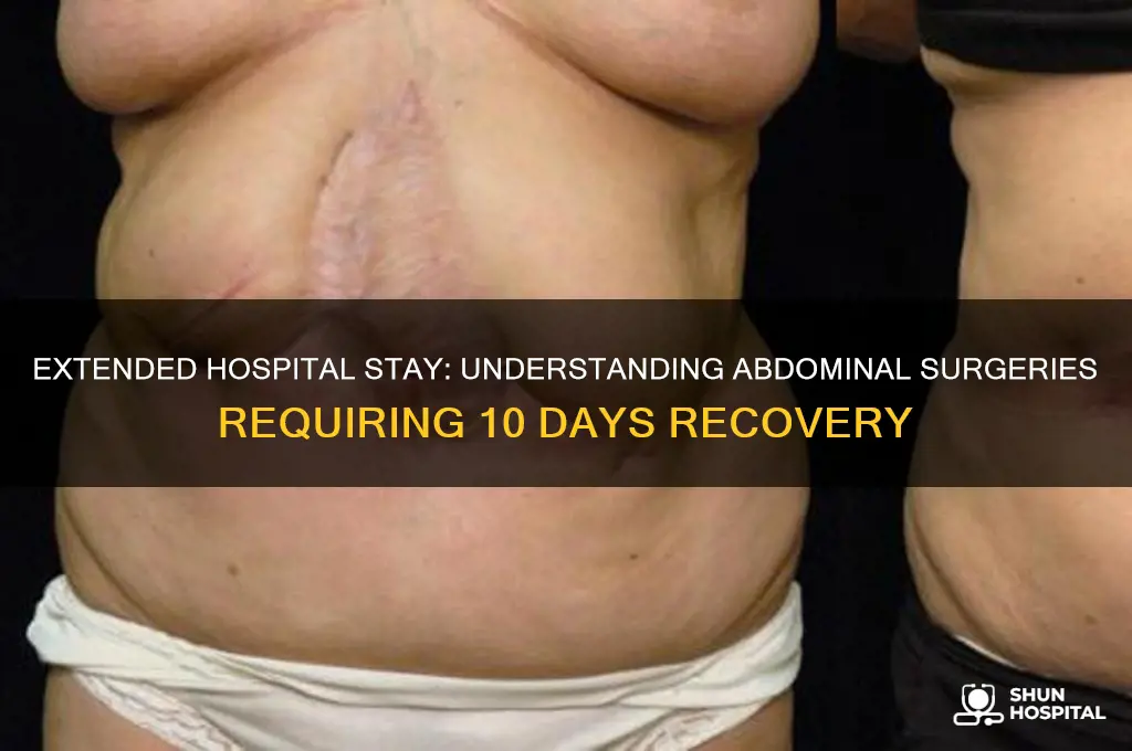 what kind of abdominal surgery requires 10 day hospital stay