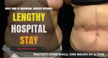 Understanding Abdominal Surgeries Requiring Extended Hospital Recovery Periods
