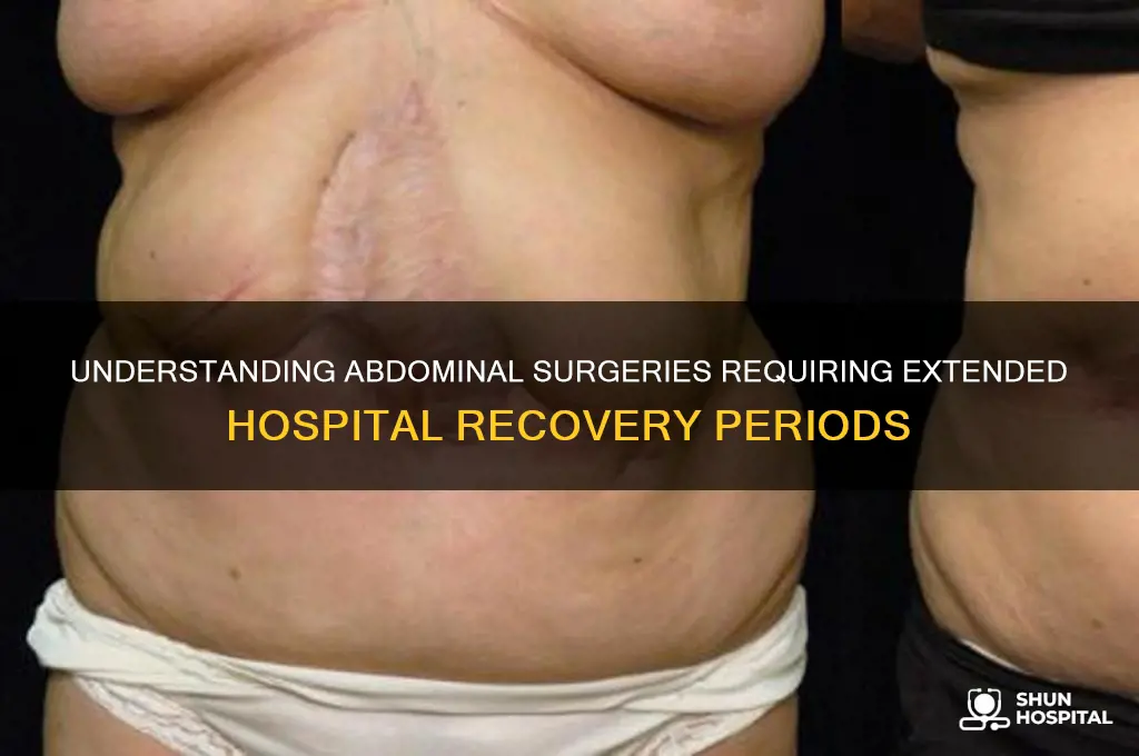 what kind of abdominal surgery requires lengthy hospital stay