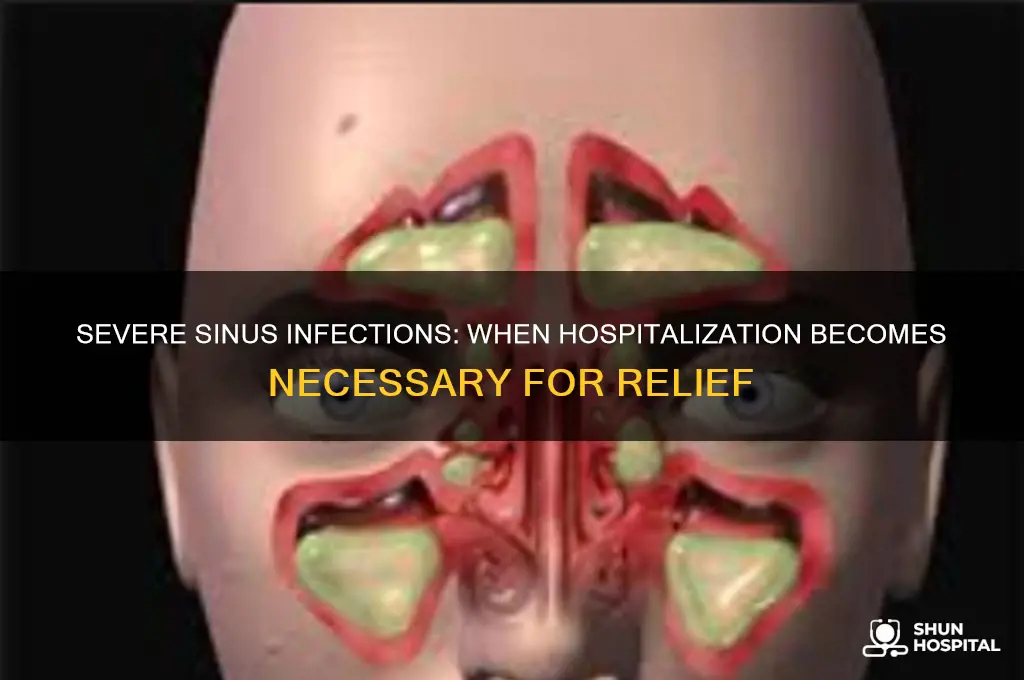 what kind of sinus problems cause you to be hospitalized