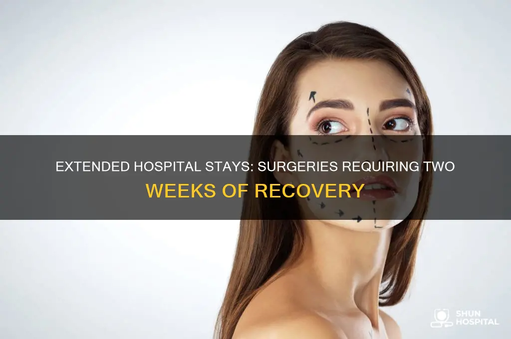 what kind of surgery requires 2 weeks in hospital