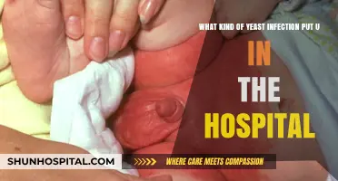 Severe Yeast Infections: When Hospitalization Becomes Necessary for Treatment