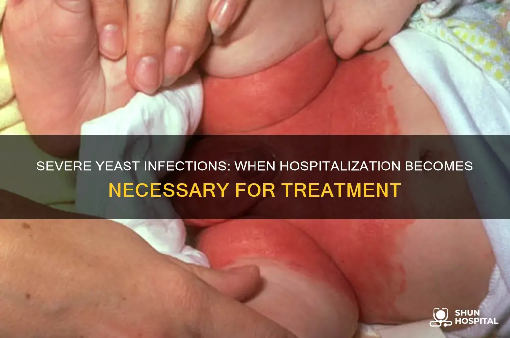 what kind of yeast infection put u in the hospital