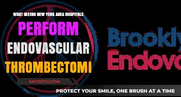 Top Metro New York Hospitals Offering Endovascular Thrombectomy Procedures