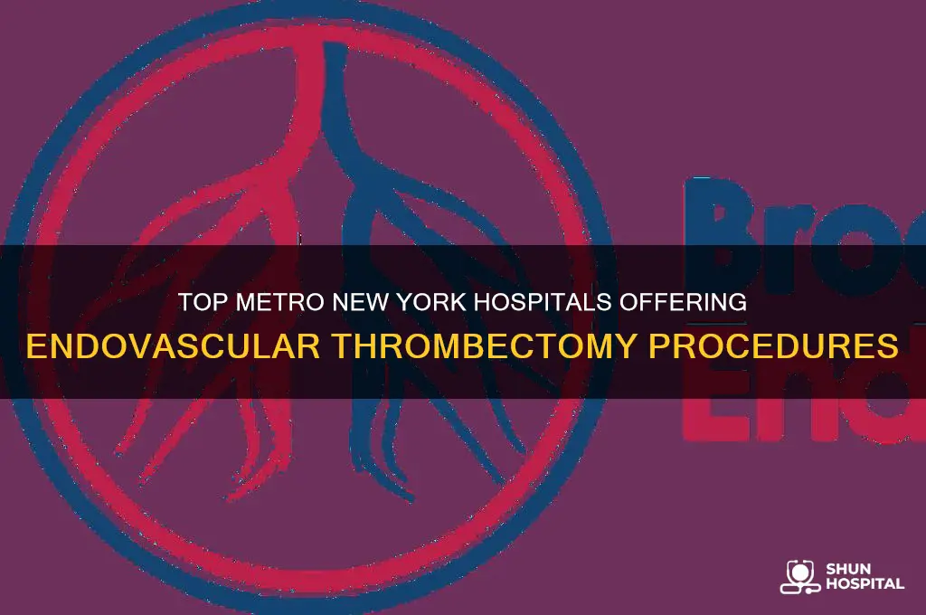 what metro new york area hospitals perform endovascular thrombectomies