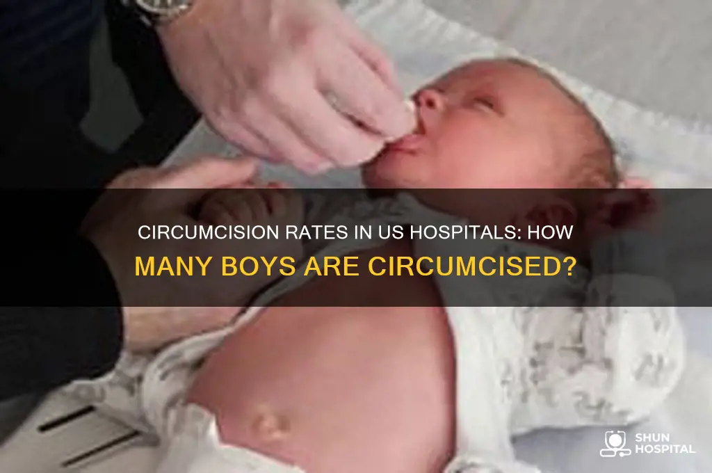 what percentage of boys born in us hospital are circumcised