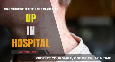 Measles Hospitalization Rates: Understanding the Percentage of Severe Cases