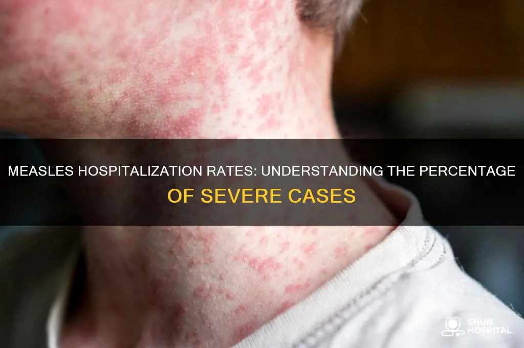 what percentage of people with measles end up in hospital
