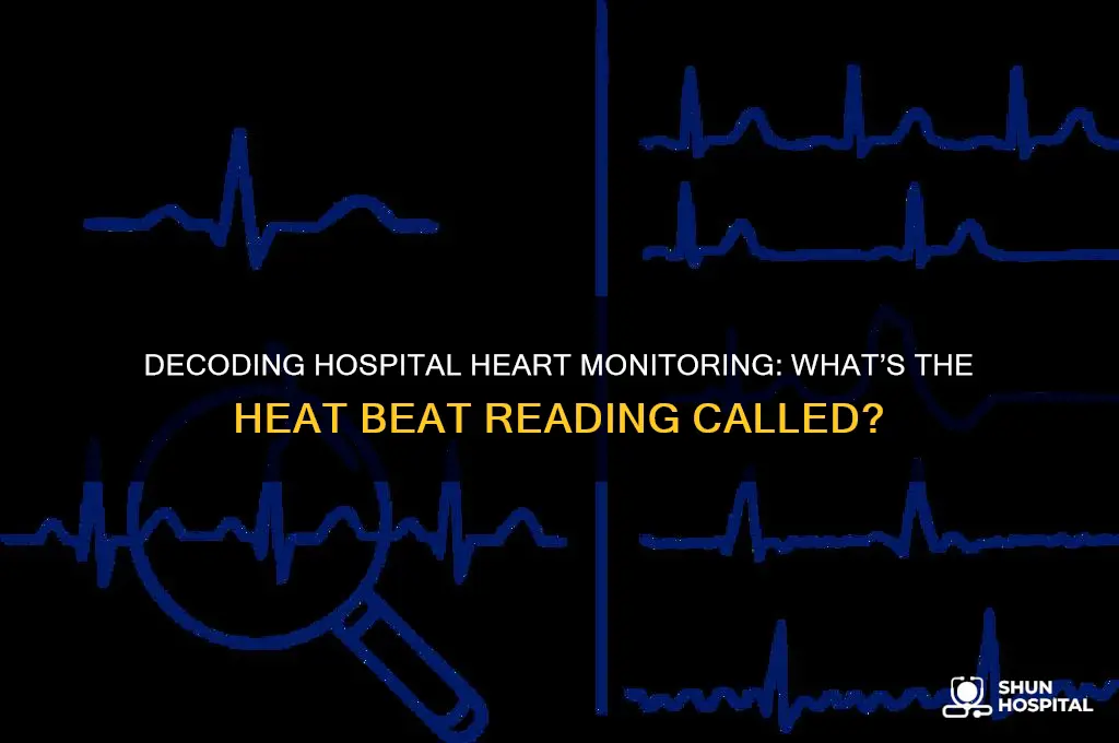 what read the heat beats in the hospital called