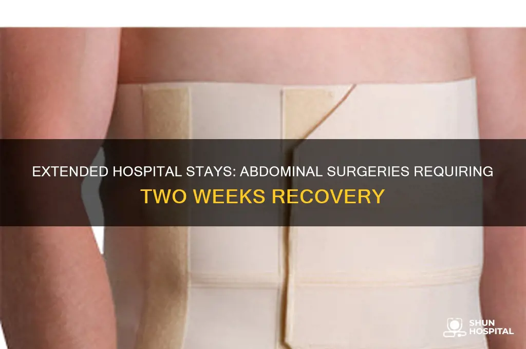 what sort of abdominal surgery requires 2 weeks in hospital