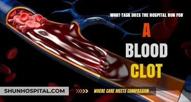 Hospital Protocols for Managing and Treating Blood Clots Effectively