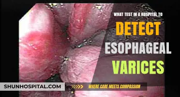 Detecting Esophageal Varices: Key Hospital Tests and Procedures Explained