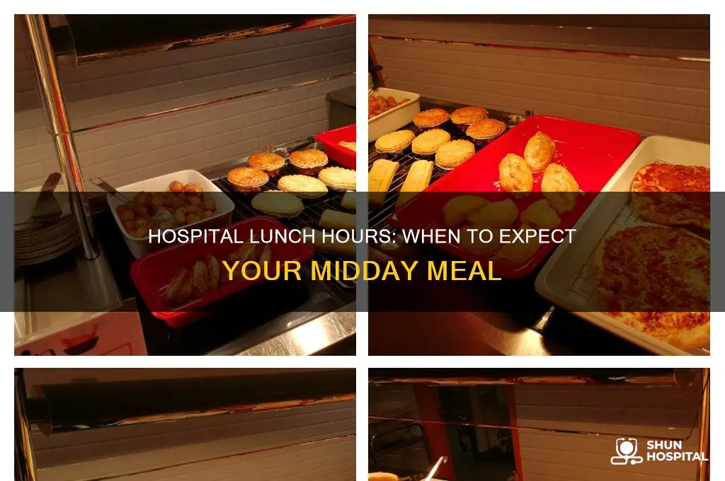 what time do they normally serve lunch at hospitals