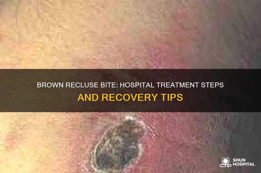 what to do when bit by brown recluse at hospital