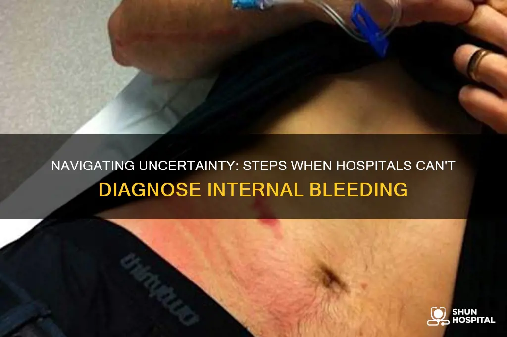 what to do when hospital cannot make diagnosis internal bleeding