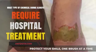 Chemical Burns: When Immediate Hospital Treatment is Absolutely Necessary