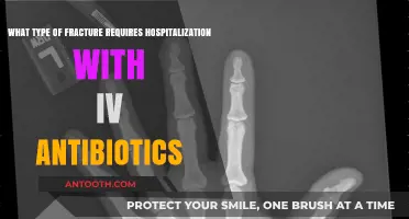 Hospitalization and IV Antibiotics: Which Fractures Demand Immediate Care?