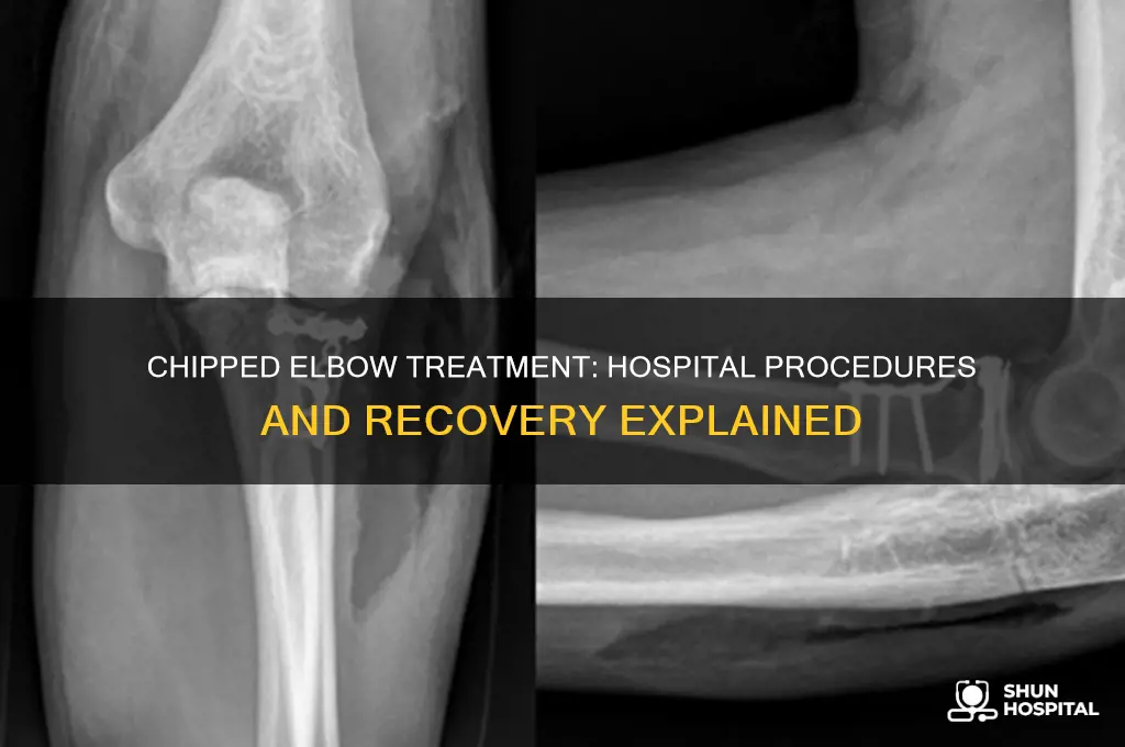 what would the hospital do for a chipped elbow