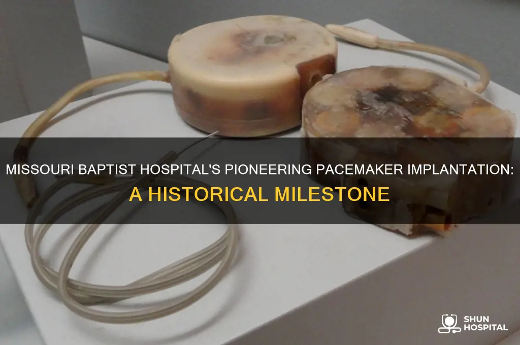 what year was 1st pacemaker implanted at missouri baptist hospital