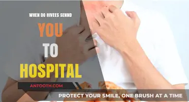 When Hivees Symptoms Escalate: Understanding Hospitalization Risks and Triggers
